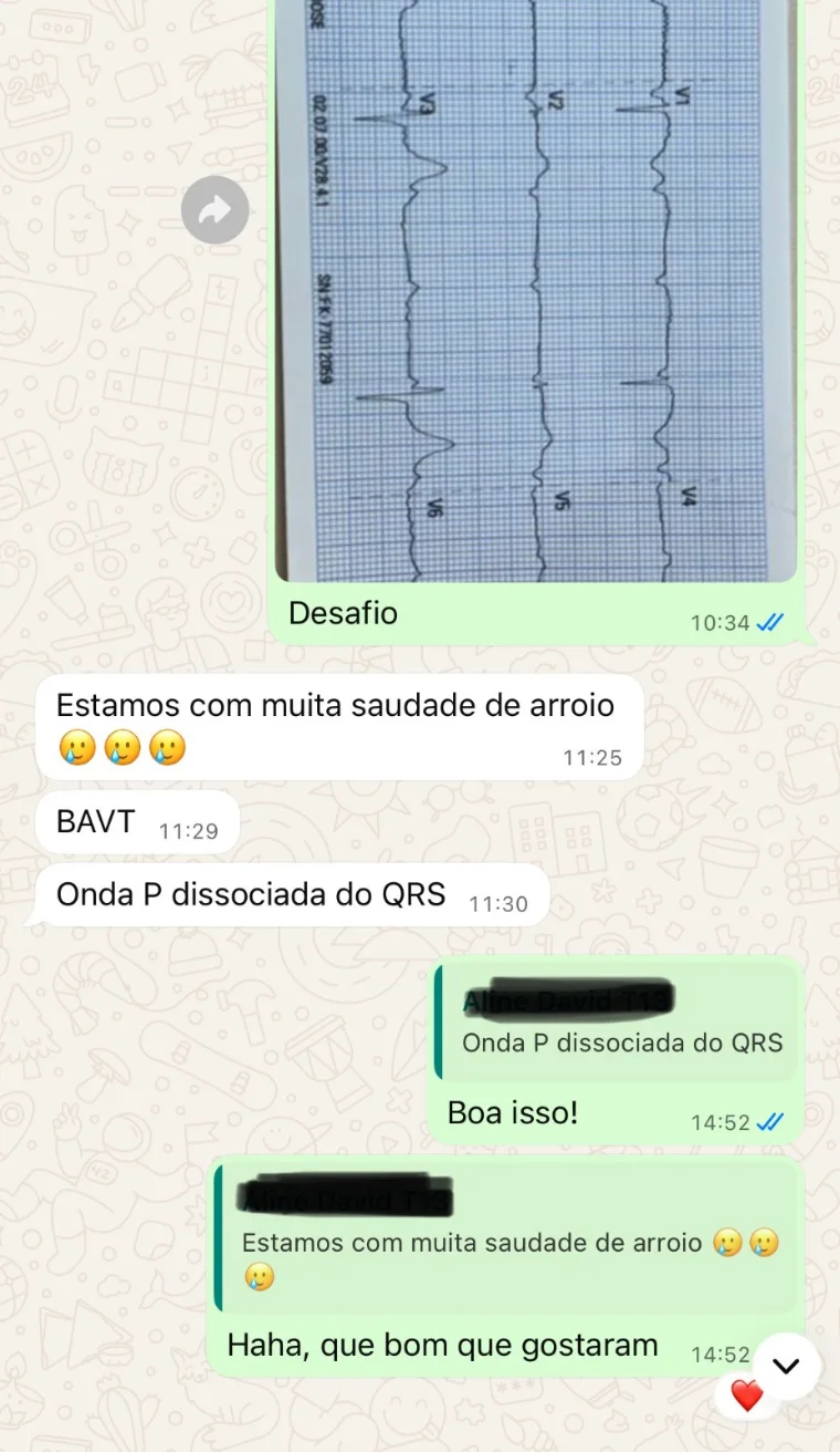 Conversa de aluno identificando um BAV total pela onda P dissociada do QRS