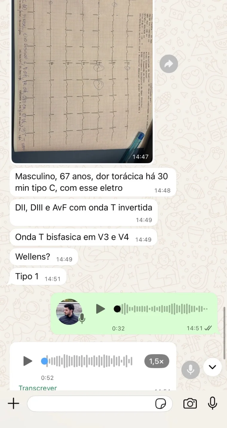 Conversa de aluna reconhecendo padrão de Wellens tipo 1